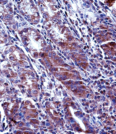 MCL1 Antibody immunohistochemistry of formalin-fixed and paraffin-embedded human stomach tissue followed by peroxidase-conjugated secondary antibody and DAB staining.