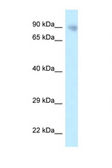 PPP6R3 / SAPS3 antibody LS-C145821 Western blot of 721_B Cell lysate. Antibody concentration 1 ug/ml.
