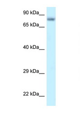 PPP6R3 / SAPS3 antibody LS-C145822 Western blot of HepG2 Cell lysate. Antibody concentration 1 ug/ml.