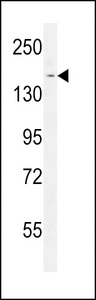 PPRC1 Antibody western blot of Jurkat cell line lysates (35 ug/lane). The PPRC1 antibody detected the PPRC1 protein (arrow).