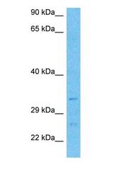 Western blot of PPT2 Antibody with human Fetal Liver lysate.