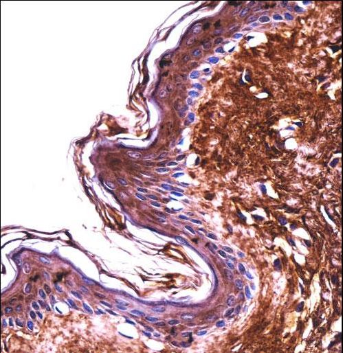 PPT2 Antibody immunohistochemistry of formalin-fixed and paraffin-embedded human skin tissue followed by peroxidase-conjugated secondary antibody and DAB staining.