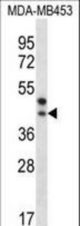 PPT2 Antibody western blot of MDA-MB453 cell line lysates (35 ug/lane). The PPT2 antibody detected the PPT2 protein (arrow).