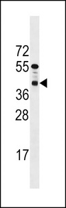 PPTC7 Antibody western blot of mouse bladder tissue lysates (35 ug/lane). The PPTC7 antibody detected the PPTC7 protein (arrow).