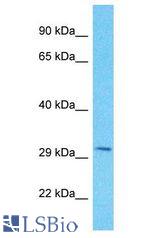 PPTC7 antibody Western Blot of MDA-MB-435S. Antibody dilution: 1 ug/ml.
