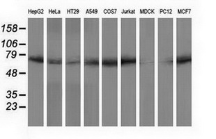 Western blot of extracts (35 ug) from 9 different cell lines by using anti-PPWD1 monoclonal antibody.