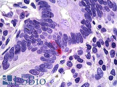 Anti-PPY antibody IHC of human intestine, neuroendocrine cells. Immunohistochemistry of formalin-fixed, paraffin-embedded tissue after heat-induced antigen retrieval. Antibody LS-B5911 concentration 5 ug/ml.