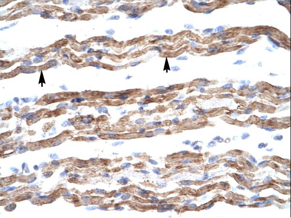 PQBP1 antibody LS-C30673 was used in IHC to stain formalin-fixed, paraffin-embedded human muscle.