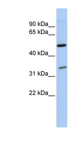 PQBP1 antibody LS-C101382 Western blot of OVCAR-3 cell lysate.