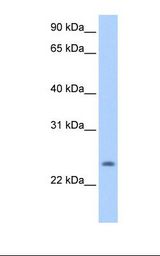 Hela cell lysate. Antibody concentration: 0.5 ug/ml. Gel concentration: 12%.