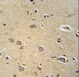 PQLC1 antibody immunohistochemistry of formalin-fixed and paraffin-embedded human brain tissue followed by peroxidase-conjugated secondary antibody and DAB staining.