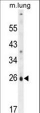 PQLC1 Antibody western blot of mouse lung tissue lysates (35 ug/lane). The PQLC1 antibody detected the PQLC1 protein (arrow).