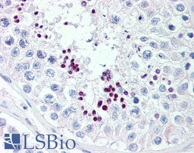 Anti-PRAC antibody IHC of human testis. Immunohistochemistry of formalin-fixed, paraffin-embedded tissue after heat-induced antigen retrieval. Antibody LS-B298 concentration 10 ug/ml.