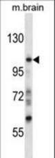 Mouse Sgk223 Antibody western blot of mouse brain tissue lysates (35 ug/lane). The Sgk223 antibody detected the Sgk223 protein (arrow).