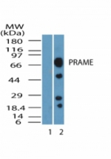 Western blot of PRAME in MCF7 cell lysate. Lane 1 shows pre-immune sera. Lane 2 shows antibody tested at 1:5000 dilution.
