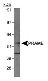 Detection of PRAME in MCF7 cell lysates.