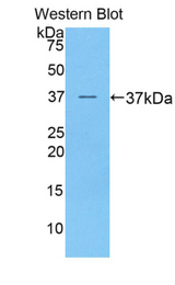 Western blot of recombinant PRAME.