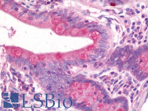 Anti-PRAME antibody IHC staining of human small intestine. Immunohistochemistry of formalin-fixed, paraffin-embedded tissue after heat-induced antigen retrieval. Antibody LS-B10827 concentration 7.5 ug/ml.