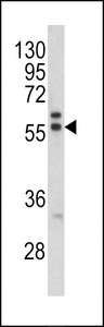 Western blot of MAPE antibody in K562 cell line lysates (35 ug/lane). MAPE (arrow) was detected using the purified antibody.