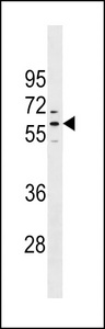 PRAMEF1 Antibody western blot of NCI-H292 cell line lysates (35 ug/lane). The PRAMEF1 antibody detected the PRAMEF1 protein (arrow).