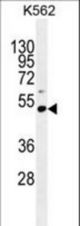 PRAMEF10 Antibody western blot of K562 cell line lysates (35 ug/lane). The PRAMEF10 antibody detected the PRAMEF10 protein (arrow).