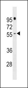 PRAMEF16 Antibody western blot of NCI-H292 cell line lysates (35 ug/lane). The PRAMEF16 antibody detected the PRAMEF16 protein (arrow).