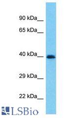 PRAMEF19 antibody Western Blot of 721_B. Antibody dilution: 1 ug/ml.