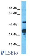 PRAMEF2 antibody Western Blot of OVCAR-3. Antibody dilution: 1 ug/ml.