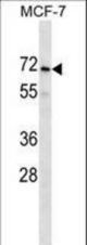 PRAMEF2 Antibody western blot of MCF-7 cell line lysates (35 ug/lane). The PRAMEF2 antibody detected the PRAMEF2 protein (arrow).