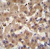 PRAMEF6 Antibody immunohistochemistry of formalin-fixed and paraffin-embedded human liver tissue followed by peroxidase-conjugated secondary antibody and DAB staining.