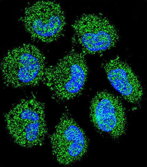 Confocal immunofluorescent of PRAMEF6 Antibody with NCI-H460 cell followed by Alexa Fluor 488-conjugated goat anti-rabbit lgG (green). DAPI was used to stain the cell nuclear (blue).
