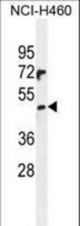 PRAMEF6 Antibody western blot of NCI-H460 cell line lysates (35 ug/lane). The PRAMEF6 antibody detected the PRAMEF6 protein (arrow).