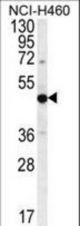 PRAMEF8 Antibody western blot of NCI-H460 cell line lysates (35 ug/lane). The PRAMEF8 antibody detected the PRAMEF8 protein (arrow).
