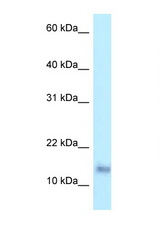 PRAP1 antibody LS-C145814 Western blot of 1 Cell lysate. Antibody concentration 1 ug/ml.