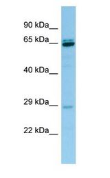 PRB3 antibody Western Blot of HeLa.