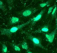 Immunofluorescent staining of HeLa cells using anti-PRC1 antibody.