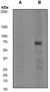 Western blot analysis on HeLa cell lysates using anti-Phospho-PRC1 (pT481) antibody, 1:500 dilution. Cells were either (A) untreated (B) treated with aphidicolin + nocodazole.