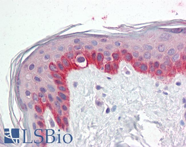 Anti-PRC1 antibody IHC staining of human skin. Immunohistochemistry of formalin-fixed, paraffin-embedded tissue after heat-induced antigen retrieval.