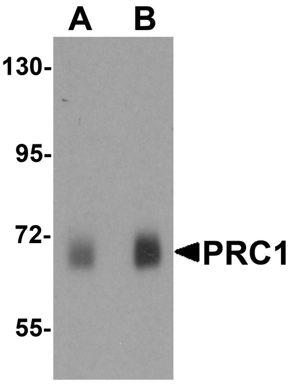 Western blot analysis of PRC1 in human skeletal muscle tissue lysate with Prc1 antibody at (A) 0.5 ug/ml and (B) 1 ug/ml.