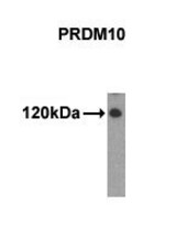 Western of extracts from 293 cells using PRDM10 antibody.