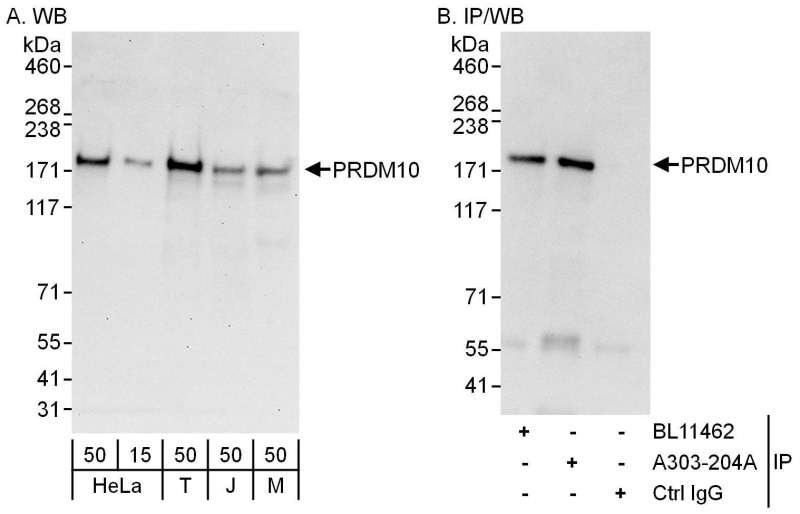 Detection of Human and Mouse PRDM10 by Western Blot (h and m) and Immunoprecipitation (h). Samples: Whole cell lysate from HeLa (15 and 50 ug for WB; 1 mg for IP, 20% of IP loaded), 293T (T; 50 ug), Jurkat (J; 50 ug) and mouse NIH3T3 (M; 50 ug) cells. Antibodies: Affinity purified rabbit anti-PRDM10 antibody used for WB at 0.1 ug/ml (A) and 1 ug/ml (B) and used for IP at 6 ug/mg lysate. PRDM10 was also immunoprecipitated by rabbit anti-PRDM10 antibody BL11462, which recognizes an upstream epitope. Detection: Chemiluminescence with exposure times of 30 seconds (A) and 10 seconds (B).
