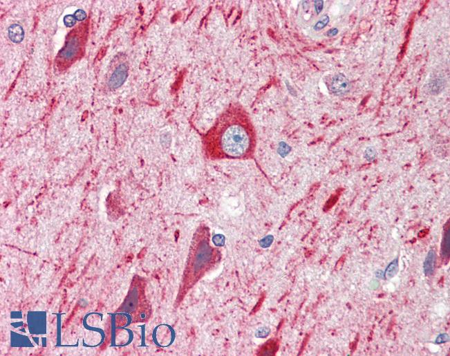 Anti-PRDM11 antibody IHC staining of human brain, cortex. Immunohistochemistry of formalin-fixed, paraffin-embedded tissue after heat-induced antigen retrieval. Antibody LS-B10274 concentration 5 ug/ml.