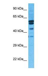 Western blot of PRD12 Antibody with human Fetal Liver lysate.