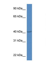 PRDM12 antibody LS-C145238 Western blot of Mouse Thymus lysate. Antibody concentration 1 ug/ml.