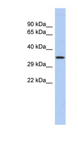 PRDM12 antibody LS-C109756 Western blot of Fetal Thymus lysate.