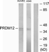 Western blot of extracts from HUVEC/A549 cells, using PRDM12 Antibody. The lane on the right is treated with the synthesized peptide.