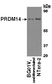 Detection of PRDM14. Cell lysates were resolved by SDS-PAGE, transferred to an Immobilon-P membrane and immunoblotted with 0.1 ug/ml sheep anti-hPRDM14.