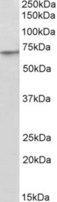 PRDM14 antibody (2 ug/ml) staining of A549 lysate (35 ug protein in RIPA buffer). Primary incubation was 1 hour. Detected by chemiluminescence.