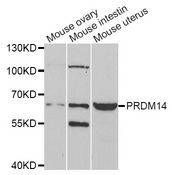 Western blot analysis of extracts of various cell lines, using PRDM14 antibody.