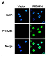 Immunofluorescence of PRDM14 in breast cancer cells. SKBr-3 cells were transfected with pCMV-Tag2A or pCMV-PRDM14 and then labeled with anti-PRDM14 antibody. The nucleus was stained with DAPI.